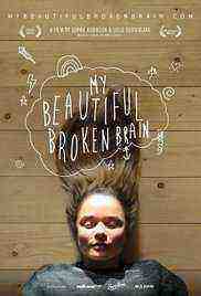 My Beautiful Broken Brain (2014)